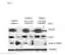 Fig. 12 - COMPOSITIONS AND METHODS FOR IDENTIFYING AND TREATING CONDITIONS INVOLVING HSF1 ACTIVITY
