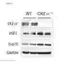 Fig. 56 - COMPOSITIONS AND METHODS FOR IDENTIFYING AND TREATING CONDITIONS INVOLVING HSF1 ACTIVITY