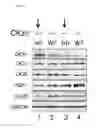 Fig. 58 - COMPOSITIONS AND METHODS FOR IDENTIFYING AND TREATING CONDITIONS INVOLVING HSF1 ACTIVITY
