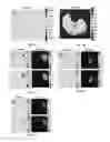 Fig. 07 - Chemical exchange saturation transfer (CEST) imaging of lactate (LATEST)