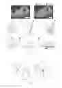 Fig. 05 - Downhole interpretation techniques using borehole dips