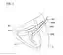 Fig. 04 - Support member for wearable device