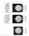 Fig. 09 - Methods and devices for modeling the eye