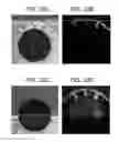 Fig. 33 - Methods and devices for modeling the eye