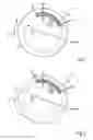 Fig. 02 - Laminated core of a stator or a rotor and electrical machine