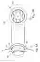 Fig. 02 - Optical equipment for observation of the iridocorneal zone, methods of measuring and/or evaluating the iridocorneal zone