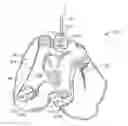 Fig. 01 - PATIENT-SPECIFIC-BONE-CUTTING GUIDANCE INSTRUMENTS AND METHODS