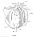 Fig. 07 - PATIENT-SPECIFIC-BONE-CUTTING GUIDANCE INSTRUMENTS AND METHODS