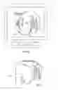Fig. 08 - PATIENT-SPECIFIC-BONE-CUTTING GUIDANCE INSTRUMENTS AND METHODS