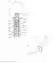 Fig. 02 - Post-operatively adjustable angled rod