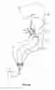 Fig. 09 - Vapor ablation system with a catheter having more than one positioning element