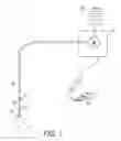 Fig. 02 - Vapor ablation system with a catheter having more than one positioning element and configured to treat pulmonary tissue