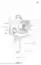 Fig. 02 - Artificial knee joint