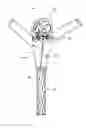 Fig. 01 - Vascular remodeling device