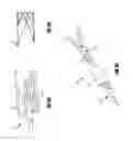 Fig. 08 - Vascular remodeling device