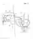 Fig. 04 - Pubic catheter apparatus