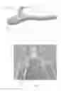Fig. 07 - Mouth cooler