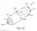 Fig. 02 - Methods for delivering etanercept preparations into a lumen of the intestinal tract using a swallowable drug delivery device
