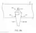 Fig. 35 - Methods for delivering etanercept preparations into a lumen of the intestinal tract using a swallowable drug delivery device