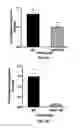 Fig. 08 - Methods and compositions for prevention and treatment of cardiac hypertrophy