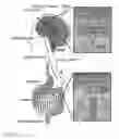 Fig. 02 - Elevated intracranial pressure treatment