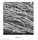Fig. 15 - Chitosan superfine fiber systems