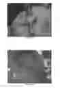 Fig. 30 - Chitosan superfine fiber systems