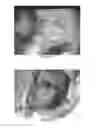 Fig. 33 - Chitosan superfine fiber systems