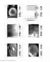 Fig. 17 - Elastic biopolymer and use as a tissue adhesive