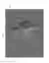 Fig. 13 - Bioactive composites of polymer and glass and method for making same
