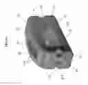 Fig. 27 - Bioactive composites of polymer and glass and method for making same