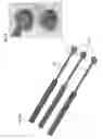 Fig. 50 - Bioactive composites of polymer and glass and method for making same