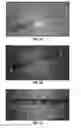 Fig. 04 - TISSUE INTEGRATING MATERIALS FOR WOUND REPAIR