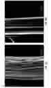 Fig. 06 - TISSUE INTEGRATING MATERIALS FOR WOUND REPAIR