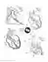 Fig. 02 - Support stent for transvalvular conduit