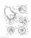 Fig. 03 - Support stent for transvalvular conduit