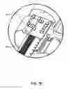 Fig. 44 - Infusion pump assembly
