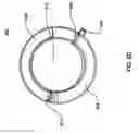Fig. 48 - Infusion pump assembly