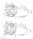 Fig. 07 - Portable drug mixing and delivery device and associated methods