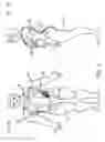 Fig. 02 - System for detecting stent slippage, method for detecting stent slippage