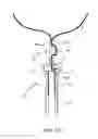 Fig. 12 - Balloon holder