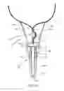 Fig. 13 - Balloon holder