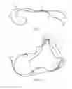 Fig. 07 - Head sling affixable to a chair