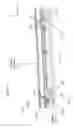 Fig. 09 - Interior body panel fit and finish tabs and methods of installation and use thereof