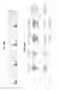 Fig. 55 - Recombinant HIV-1 envelope proteins and their use