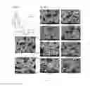 Fig. 07 - Anti-microbial peptide and method for treating microbial infection