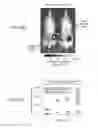 Fig. 136 - Binding-triggered transcriptional switches and methods of use thereof