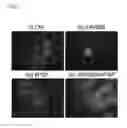 Fig. 02 - Method for proliferation of pancreatic progenitor cells