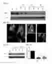 Fig. 04 - Twist signaling inhibitor compositions and methods of using the same