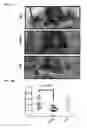 Fig. 06 - Twist signaling inhibitor compositions and methods of using the same